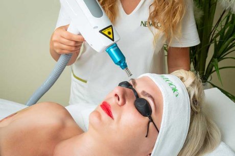 Laserowe usuwanie makijażu permanentnego brwi - umów się na zabieg